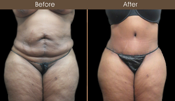 20202608152935_B87-Front-Template